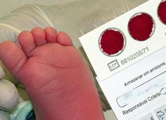 Câmara pode votar projeto que amplia número de doenças rastreadas pelo teste do pezinho 2021 03 19 22:35:40