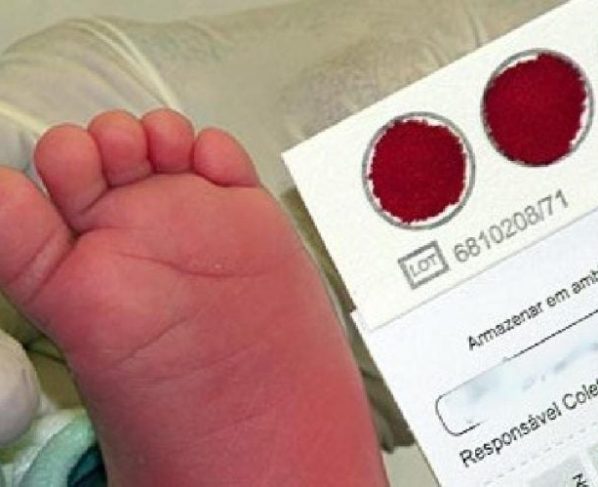 Câmara pode votar projeto que amplia número de doenças rastreadas pelo teste do pezinho 2021 03 19 22:35:40