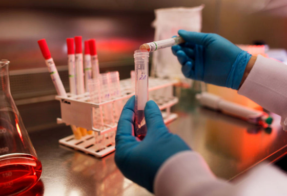 Laboratorio alvo de operacao policial fraudava exames de HIV sifilis e hepatite em Mato Grosso