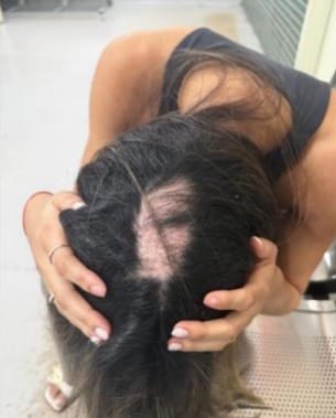 Motorista da BMW que matou motociclista já foi preso por agredir e ameaçar esposa