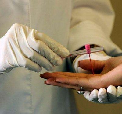 Escola de Saúde Pública de Mato Groso suspende edital para especialização em hansenologia